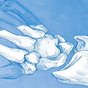 Controversies in Wrist Surgery