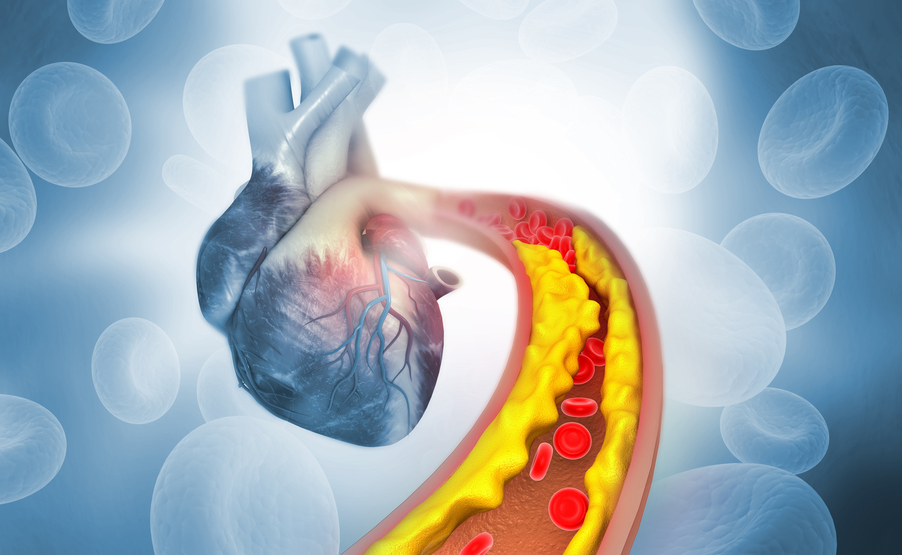 Cardiovascular Atherosclerosis: Prediction, Prevention and Management - Live Streaming CME Event