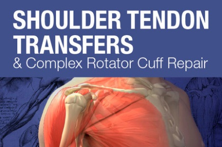 Mayo Clinic-Shoulder Tendon Transfers and Complex Rotator Cuff Repair